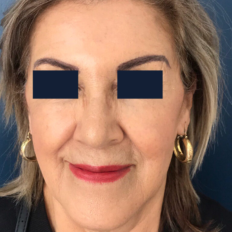 Sin título-2et-02