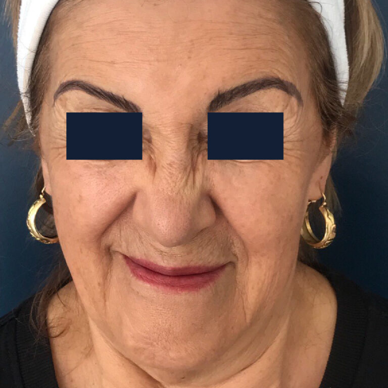 Sin título-2et-03