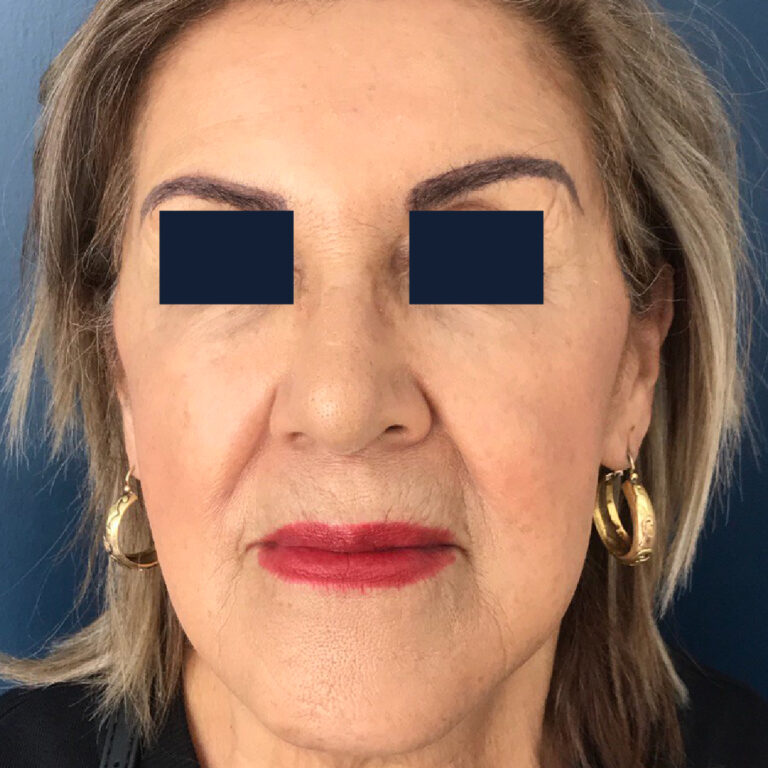 Sin título-2et-04