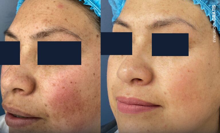 photo_5176936339608809134_y