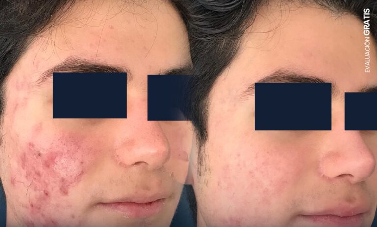 photo_5176936339608809136_y