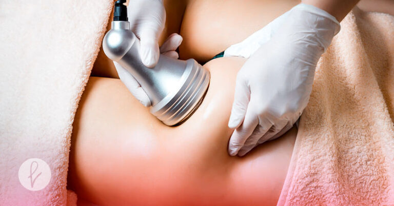 01-EN-QUE-CONSISTE-LA-ULTRACAVITACION